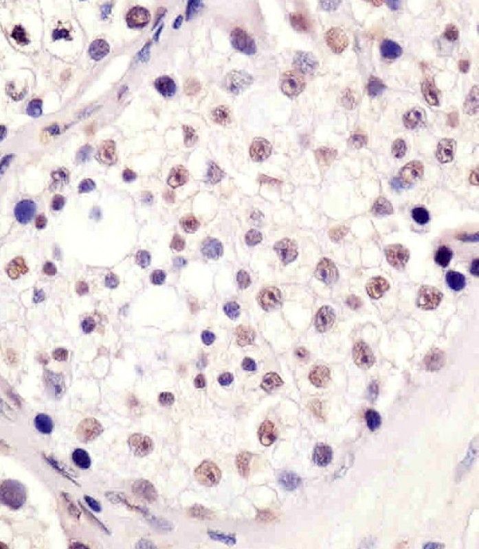 IHC-P