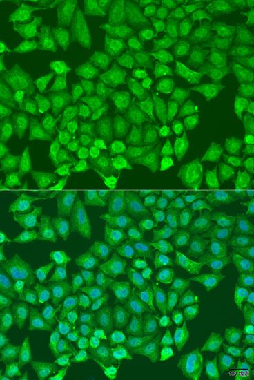 Immunofluorescence - CTCF Polyclonal Antibody (144-01133)