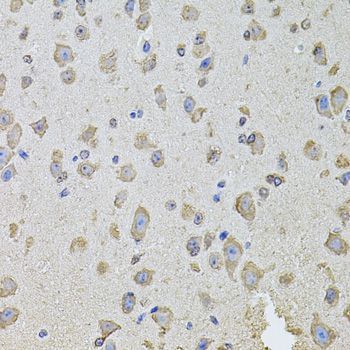 Immunohistochemistry - PHF1 antibody (144-08450)