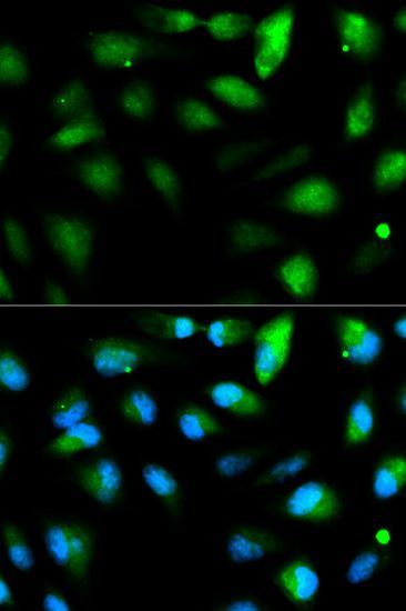 Immunofluorescence - F11R antibody (144-01241)