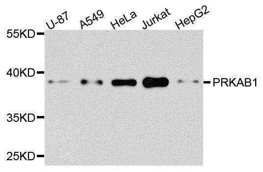Western blot - [KO Validated] PRKAB1 Polyclonal Antibody (144-600821)