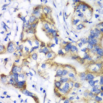 Immunohistochemistry - RPL9 Polyclonal Antibody (144-06406)