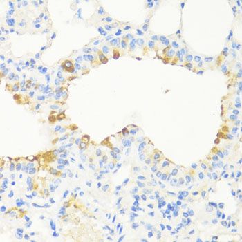 Immunohistochemistry - MAPRE3 antibody (144-09591)