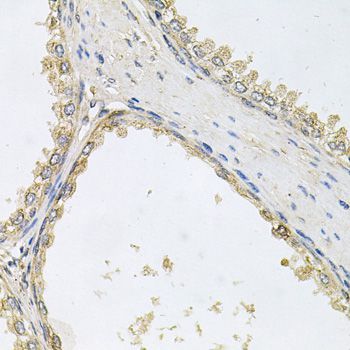 Immunohistochemistry - POMGNT1 antibody (144-09879)