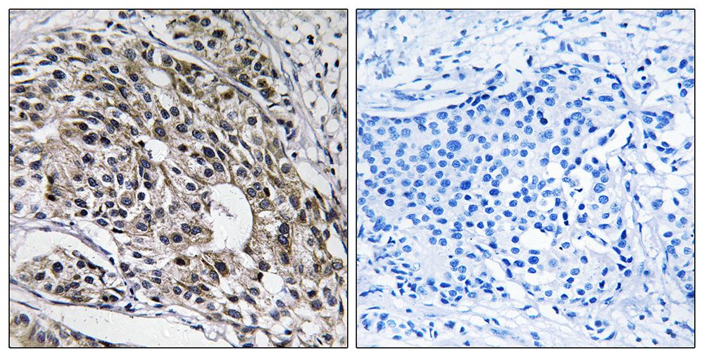 IHC