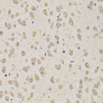 Immunohistochemistry - AAAS Antibody (144-06427)