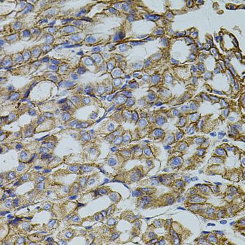 Immunohistochemistry - TRMT2A antibody (144-05975)