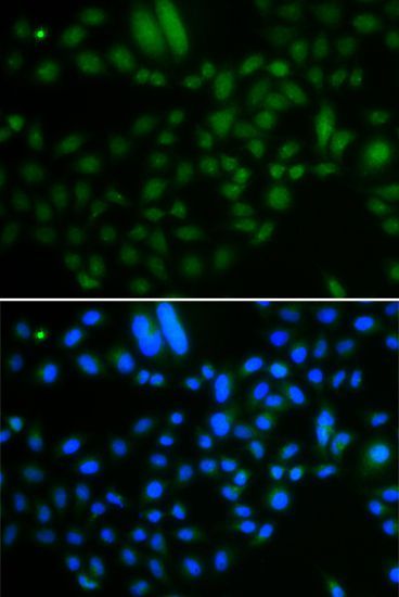 Immunofluorescence - ALKBH8 antibody (144-07142)