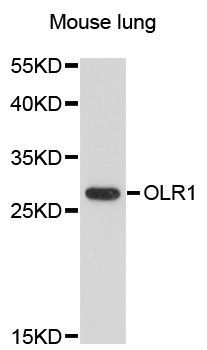 Western blot - OLR1 antibody (144-012060)