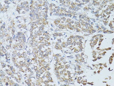 Immunohistochemistry - TEFM Polyclonal Antibody (144-08511)