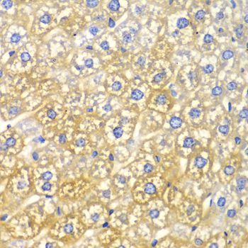 Immunohistochemistry - FASN Polyclonal Antibody (144-00461)