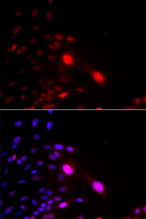 Immunofluorescence - DDB2 antibody (144-01848)