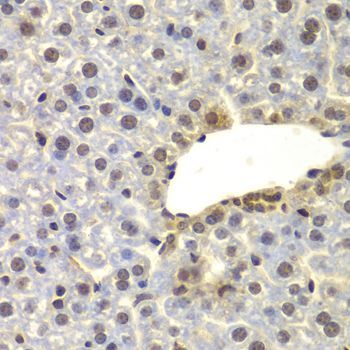 Immunohistochemistry - SUPT20H Polyclonal Antibody (144-07374)