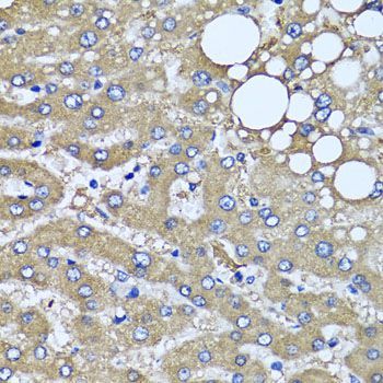 Immunohistochemistry - HYAL1 antibody (144-06623)