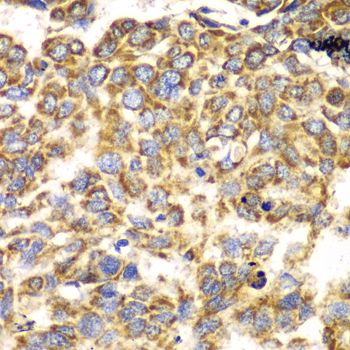 Immunohistochemistry - TOMM20 antibody (144-06774)