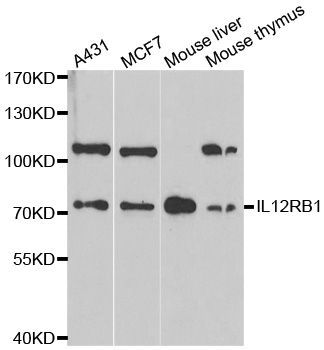 Western blot - IL12RB1 antibody (144-01886)