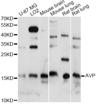 Western blot - AVP antibody (144-61317)