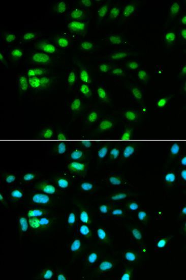 Immunofluorescence - PAX3 antibody (144-01675)