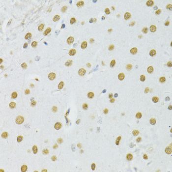 Immunohistochemistry - BRCA1 Polyclonal Antibody (144-11549)