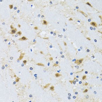 Immunohistochemistry - CCT4 antibody (144-06548)