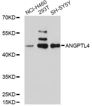 Western blot - ANGPTL4 Polyclonal Antibody (144-02011)