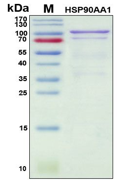 SDS-PAGE