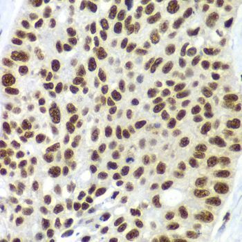 Immunohistochemistry - SF3B2 Polyclonal Antibody (144-05875)