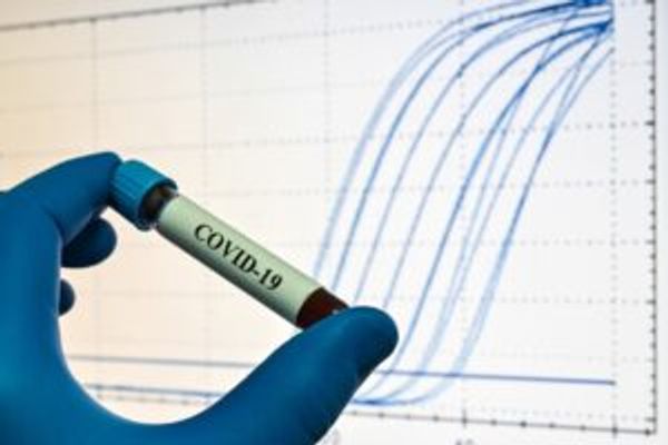 qRT-PCR is used to detect the SARS-CoV-2 virus that is responsible for COVID-19 infection.
