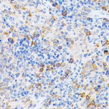 Immunohistochemistry - CHAF1B antibody (144-06259)