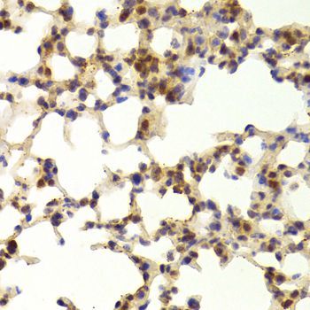 Immunohistochemistry - TAF1C Polyclonal Antibody (144-06759)