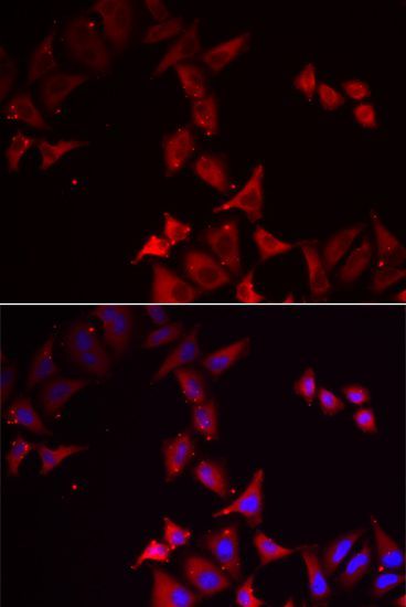 Immunofluorescence - PCBD1 Polyclonal Antibody (144-06392)