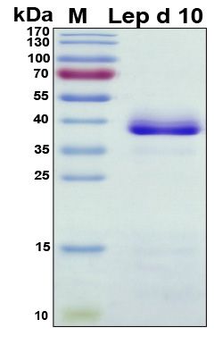 SDS-PAGE