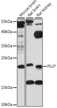 Western blot - PLLP antibody (144-61233)