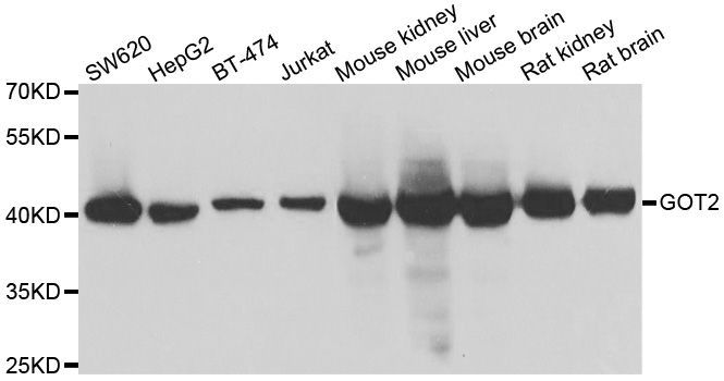 Western blot - GOT2 Polyclonal Antibody (144-06915)