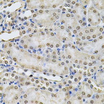 Immunohistochemistry - IFI16 Antibody (144-60546)