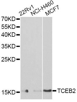 Western blot - TCEB2 Polyclonal Antibody (144-60305)