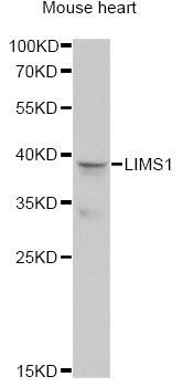 Western blot - LIMS1 antibody (144-013917)