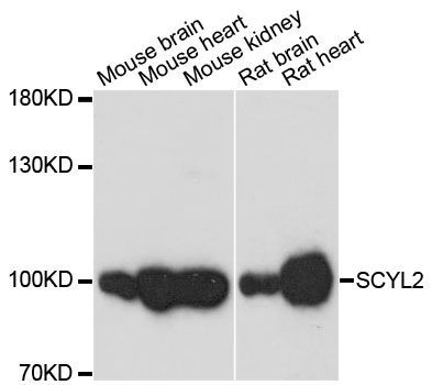 Western blot - SCYL2 antibody (144-60223)