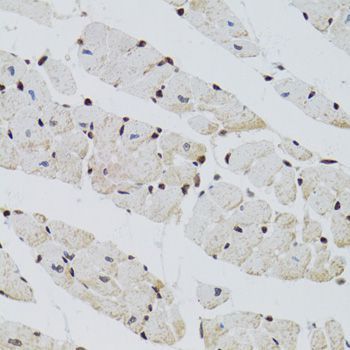 Chromatin Immunoprecipitation - CTCF Polyclonal Antibody (144-01133)