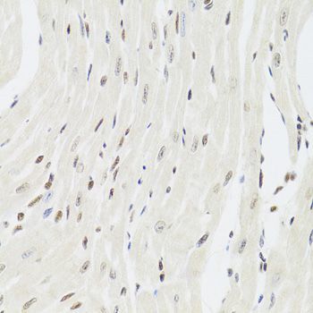 Immunohistochemistry - XRCC6 Polyclonal Antibody (144-00883)