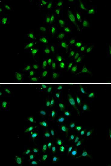 Immunofluorescence - CXXC1 antibody (144-05814)