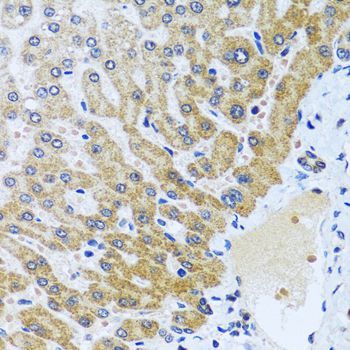 Immunohistochemistry - CPA6 antibody (144-60428)