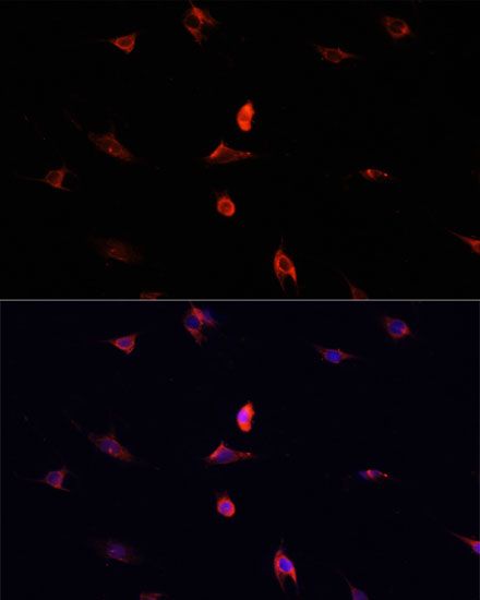 Immunofluorescence - CD4 Polyclonal Antibody (144-60019)