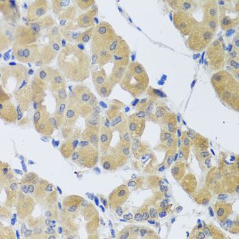 Immunohistochemistry - SNAP29 antibody (144-04290)