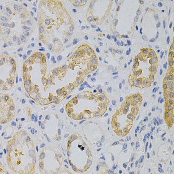Immunohistochemistry - RELA Polyclonal Antibody (144-02547)