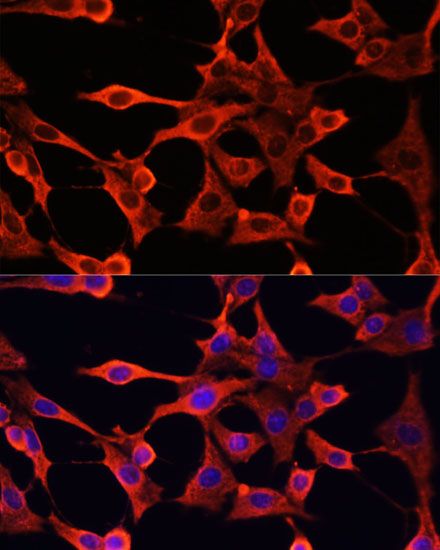 Immunofluorescence - TYMS Polyclonal Antibody (144-010441)