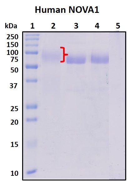 SDS-PAGE