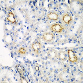 Immunohistochemistry - RARRES2 antibody (144-06963)