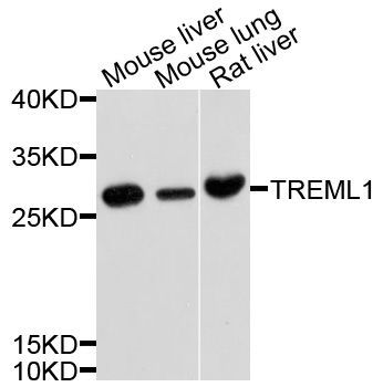 Western blot - TREML1 Polyclonal Antibody (144-10414)