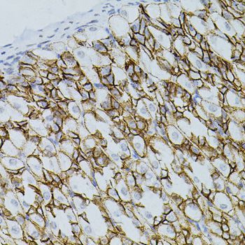 Immunohistochemistry - CLDN3 antibody (144-02946)